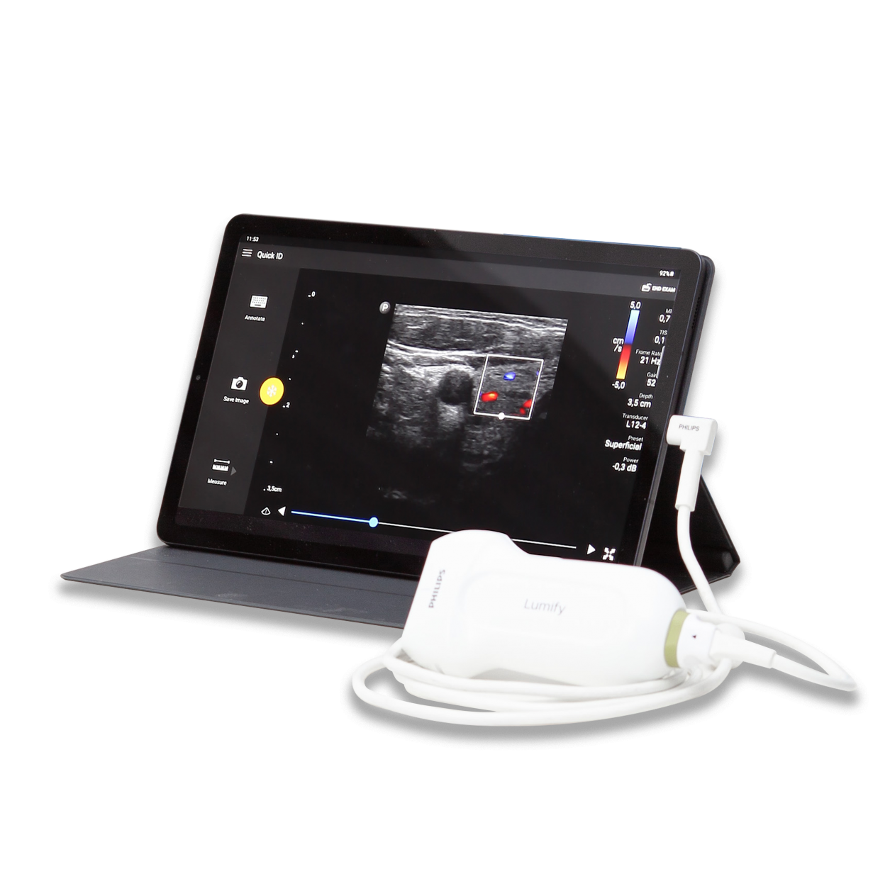 Philips Lumify L12-4U
