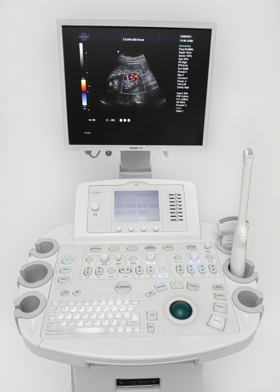 Ultrasonix SoniX OP 2