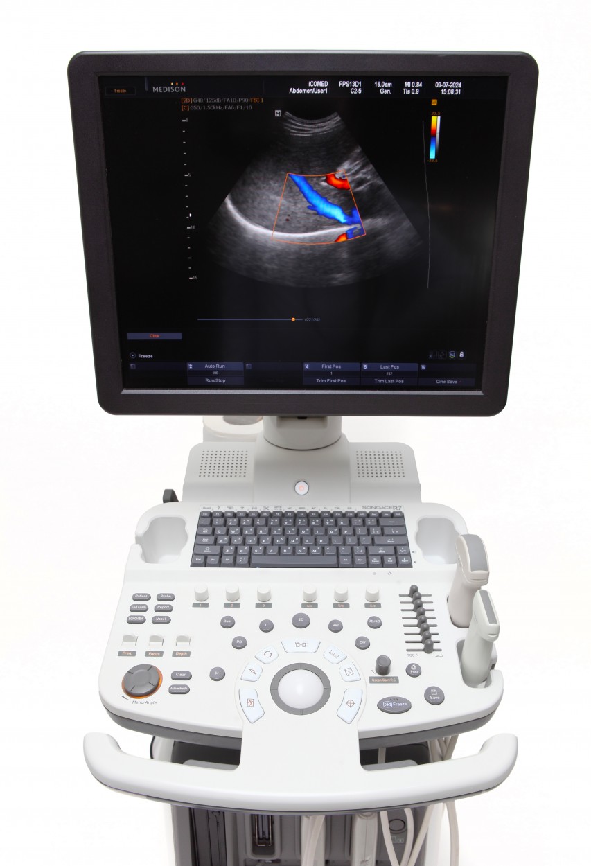 Medison SonoAce R7 1