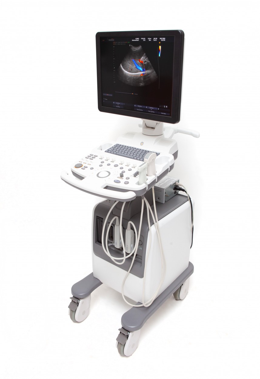 Medison SonoAce R7 3