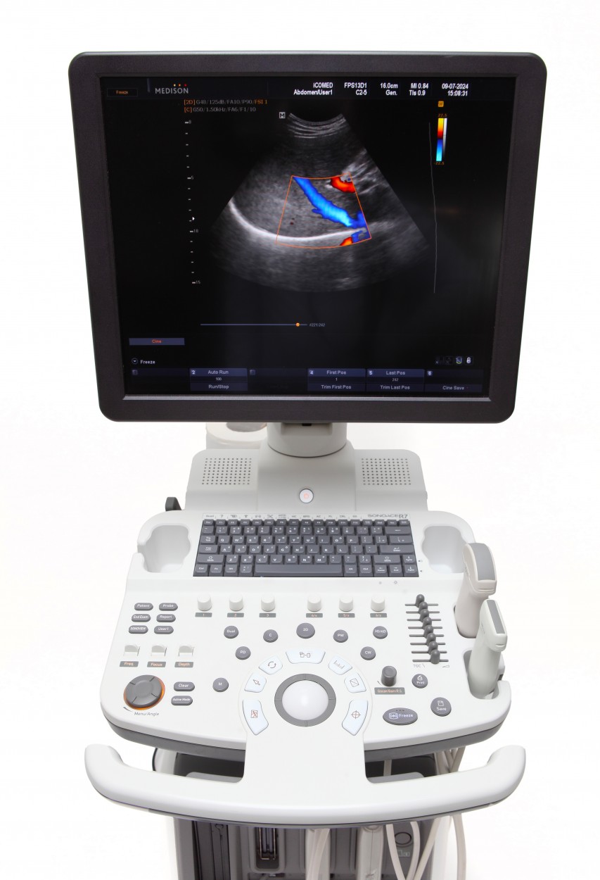 Medison Accuvix V10 4