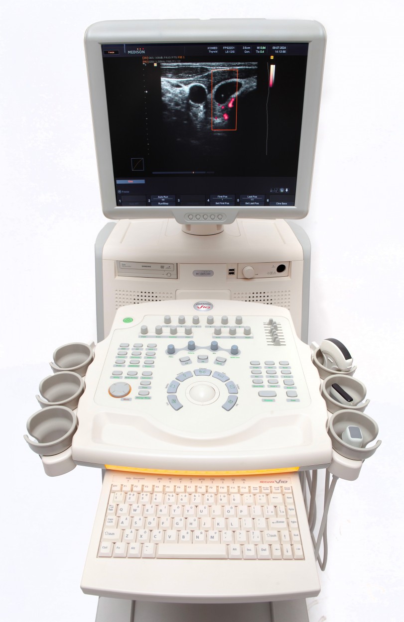 Medison Accuvix V10 1