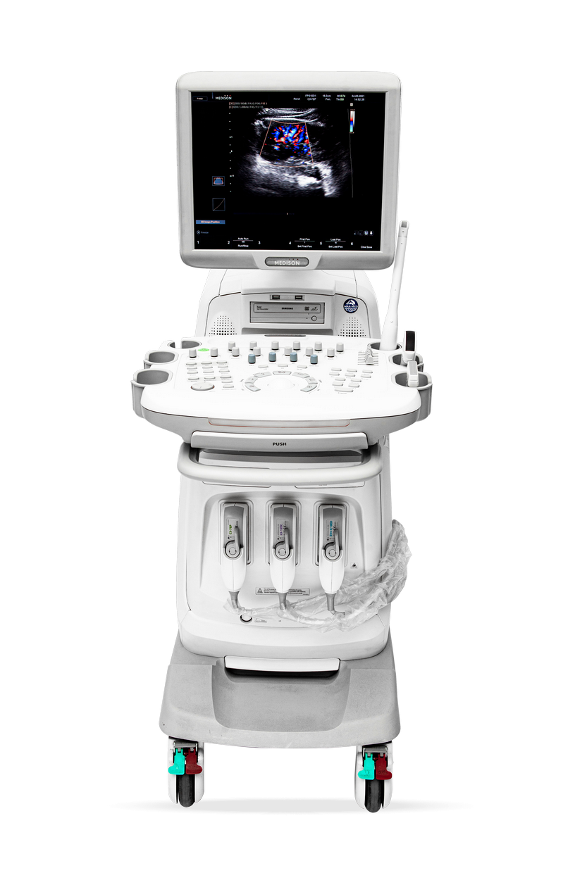 Medison SonoAce X8